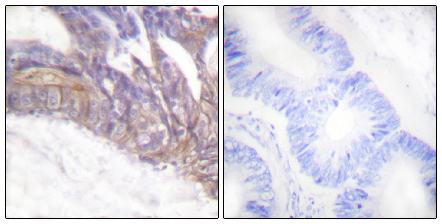 LAT Antibody (phospho-Tyr191)