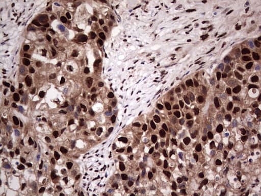 Monoclonal Mouse anti-Human SAE1 Antibody (clone OTI6B11, Carrier-free, IHC, WB)