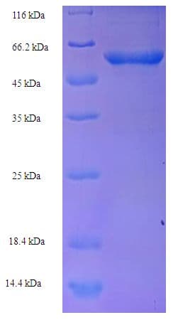 Human TCN1 Protein (Recombinant His-SUMO)