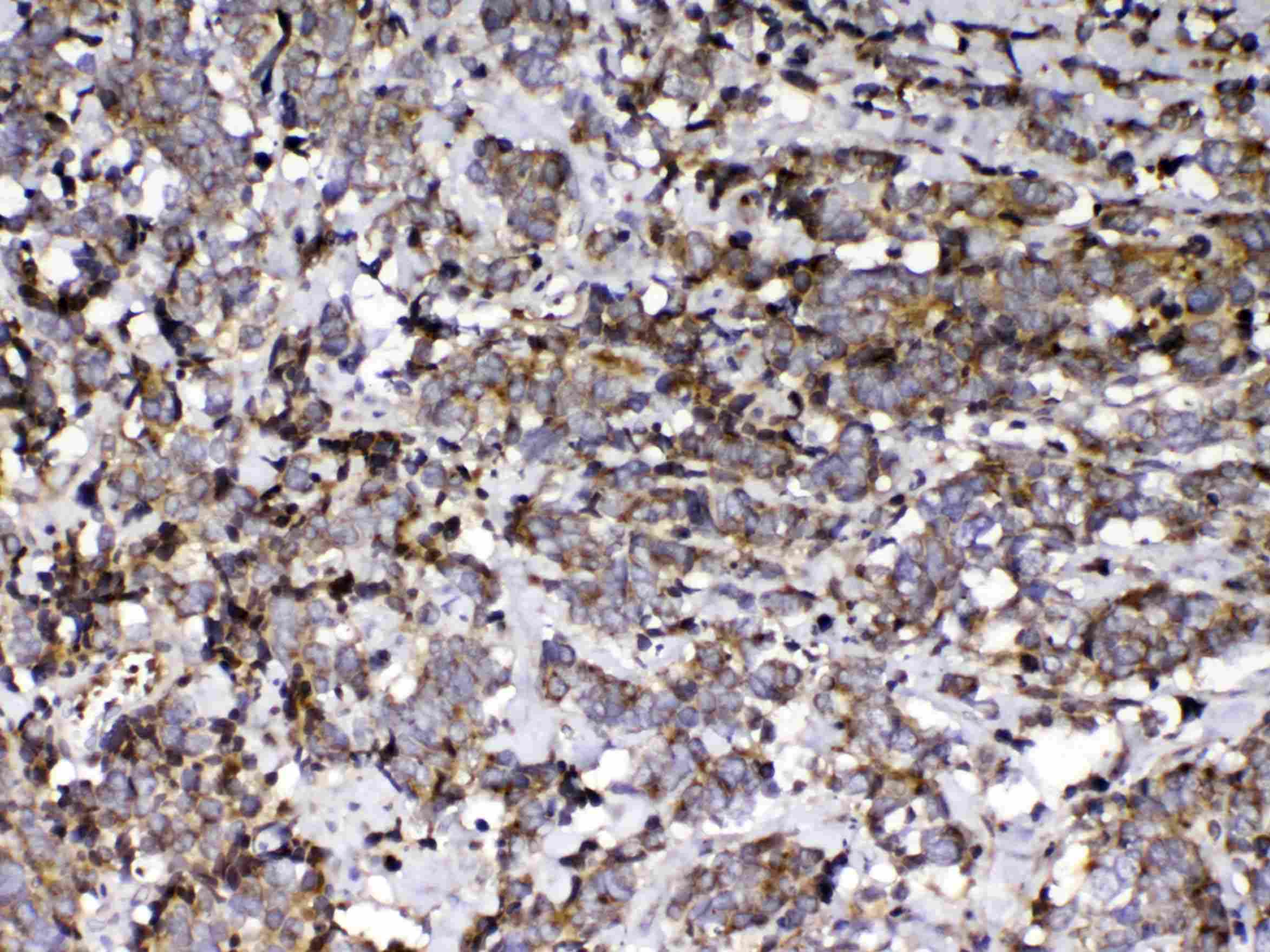 GC / Vitamin D-Binding Protein Antibody