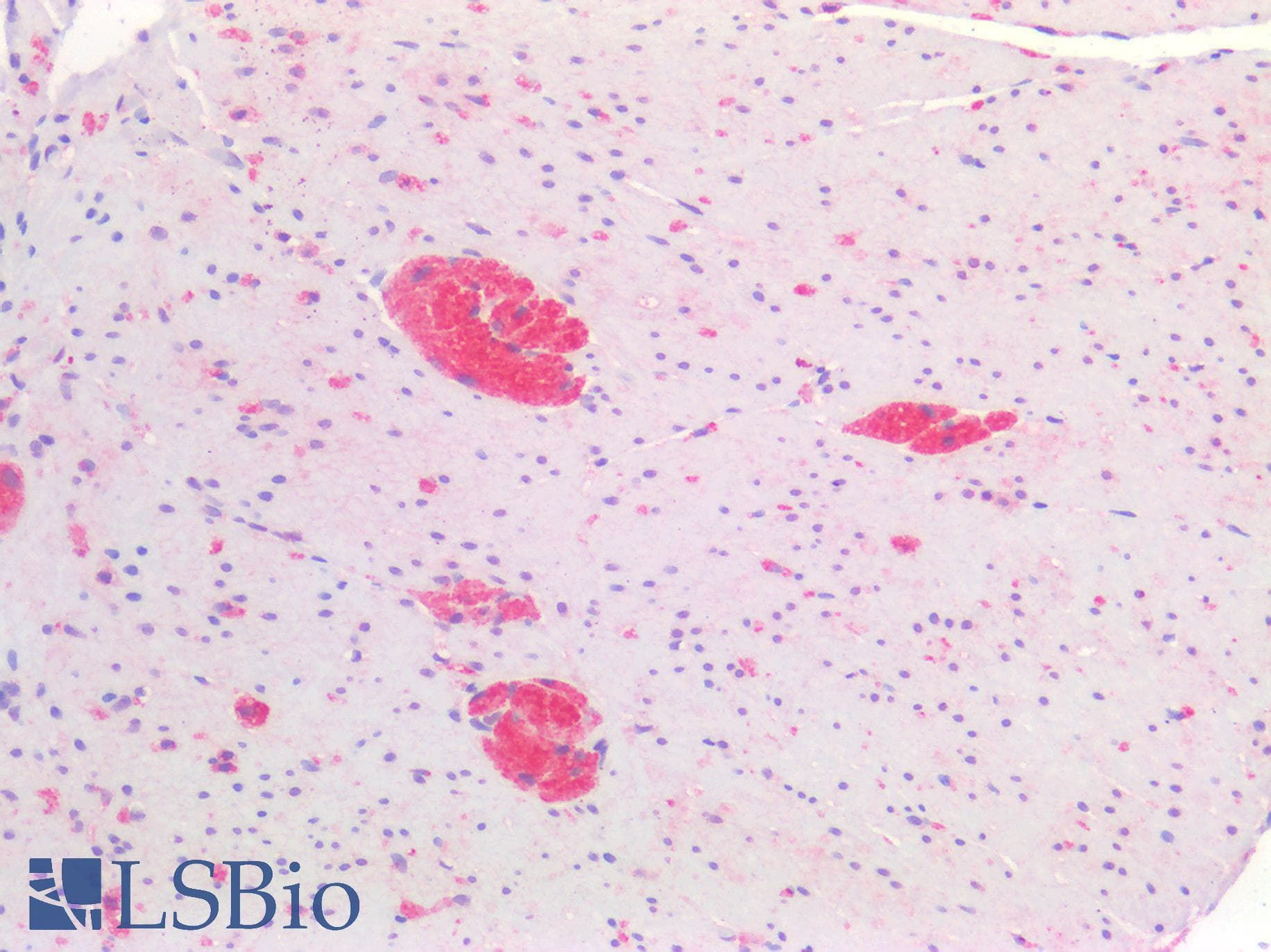 PathPlus™ MAPT / Tau Antibody