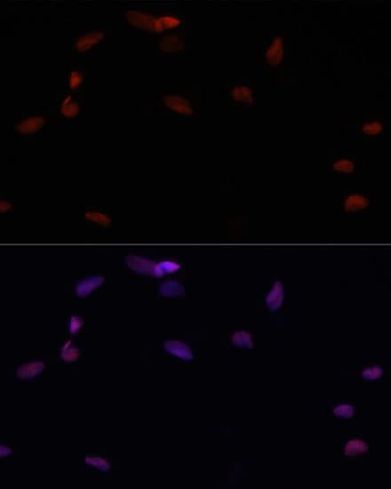 PARP1 Antibody