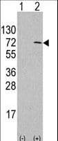 Polyclonal Rabbit anti-Human ATG4D Antibody (aa220-249, IHC, WB)