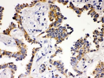 Polyclonal Rabbit anti-Human ATG14 Antibody (IHC, WB)
