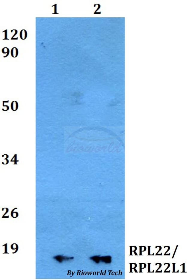 RPL22 / Ribosomal Protein L22 Antibody