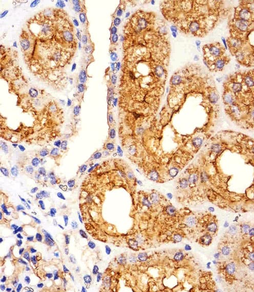 MME / CD10 Antibody (aa492-525)