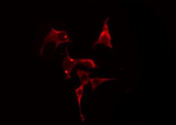 LPCAT2 Antibody
