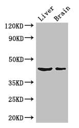Polyclonal Rabbit anti-Human METTL2A Antibody