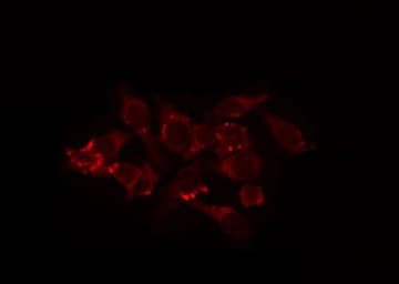 MRPL44 Antibody