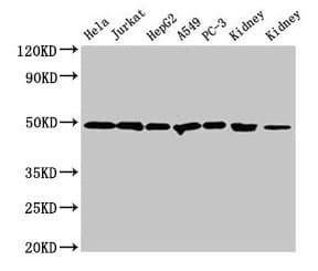 IHC-plus™ CALR / Calreticulin Antibody (aa 18-417)