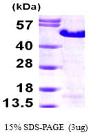 Human MAGEA3 Protein (Recombinant 6His, N-terminus)