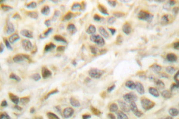 Polyclonal Rabbit anti-Human GSK3B / GSK3 Beta Antibody (Ser2, IHC, WB)