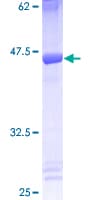 Human EIF5A Protein (Recombinant GST)