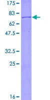Human BCKDHA / BCKDE1A Protein (Recombinant GST)