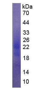 Human CSF2 / GM-CSF Protein (Recombinant His, N-Terminal)