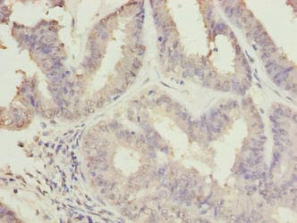 C10orf82 Antibody