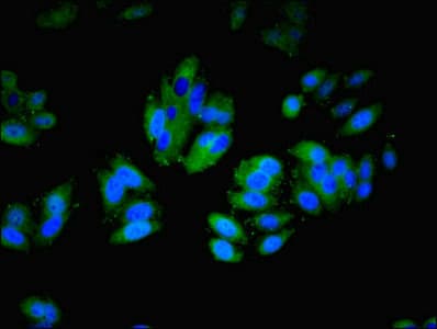 ITGAL / CD11a Antibody