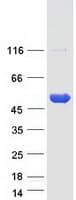 Human PIP4K2B Protein (Recombinant Myc-DDK (Flag))
