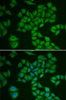 HMG-CoA Reductase / HMGCR Antibody