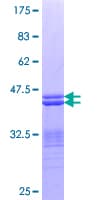 Human PLAGL1 / ZAC Protein (Recombinant GST, N-terminus)