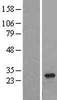 RAB8B Protein (Over-Expression Lysate Myc-DDK (Flag))
