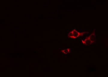 PRKCA / PKC-Alpha Antibody