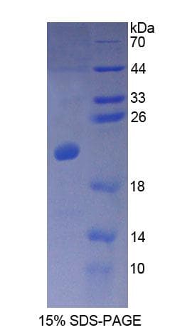 Human CALML3 Protein (Recombinant His-T7)
