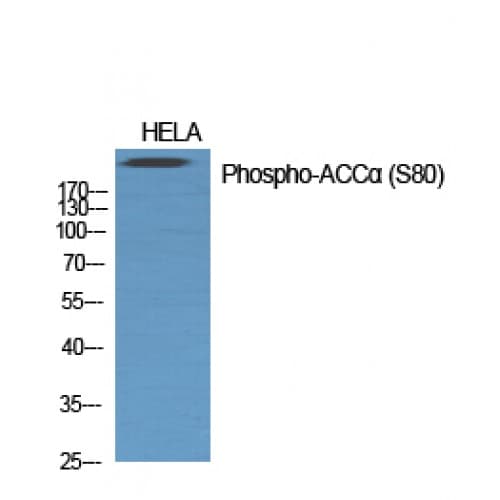 Acetyl-CoA Carboxylase / ACC Antibody (20-100 aa)