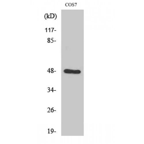 SH3GLB2 / Endophilin-B2 Antibody (100-180 aa, Internal)