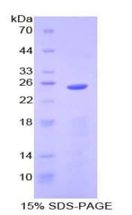 Human LCN2 / Lipocalin 2 / NGAL Protein (Recombinant His-T7)