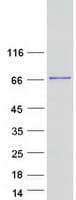 Human METTL3 Protein (Recombinant Myc-DDK (Flag))