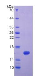 Human IFN Gamma / Interferon Gamma Protein (Recombinant His)