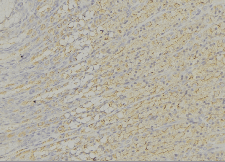Polyclonal Rabbit anti-Human ECI1 / DCI Antibody (IHC, WB)