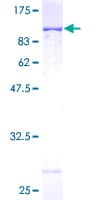 Human HSPA8 / HSC70 Protein (Recombinant GST)