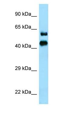 SERPINB12 Antibody (aa39-88)