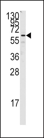 FZD1 / Frizzled 1 Antibody (aa504-533)