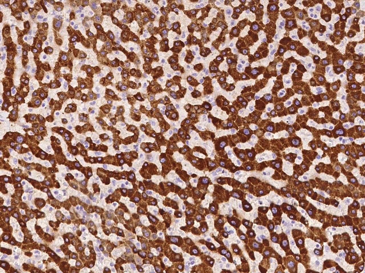 MBP / Maltose Binding Protein Antibody