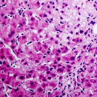 ANXA6/Annexin A6/Annexin VI Antibody (N-Terminus)