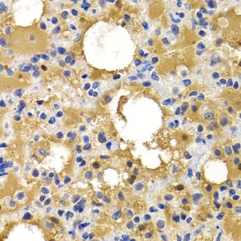 Polyclonal Rabbit anti-Human HSPB8 / H11 / HSP22 Antibody (IHC, IF, WB)