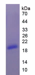Mouse CEA / Carcinoembryonic Antigen Protein (Recombinant His)