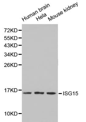 Polyclonal Rabbit anti-Human ISG15 Antibody (IHC, WB)