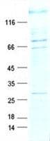 Human POGZ Protein (Recombinant DDK,C-terminus)
