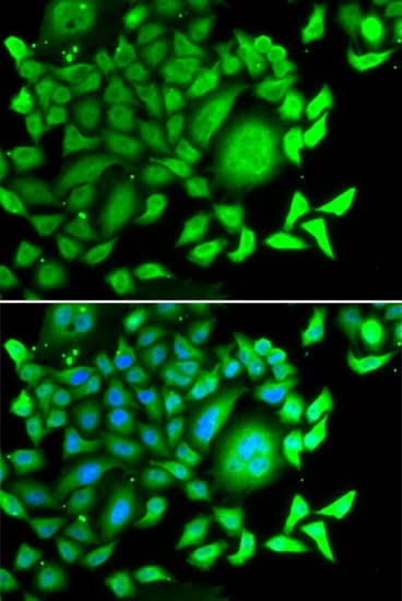 IHC-plus™ Polyclonal Rabbit anti-Human CD47 Antibody (IHC, IF, WB)