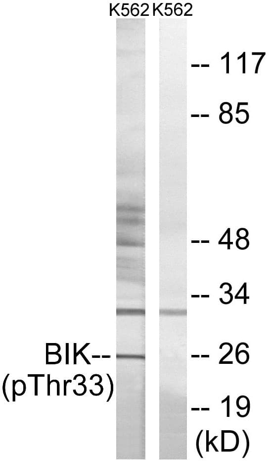 Polyclonal Rabbit anti-Human BIK Antibody (phospho-Thr33, IHC, WB)