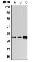 CA6 / Carbonic Anhydrase 6 Antibody (C-Terminus)