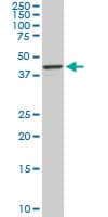 Monoclonal Mouse anti-Human RASSF8 Antibody (clone 2G1, IHC, IF, WB)