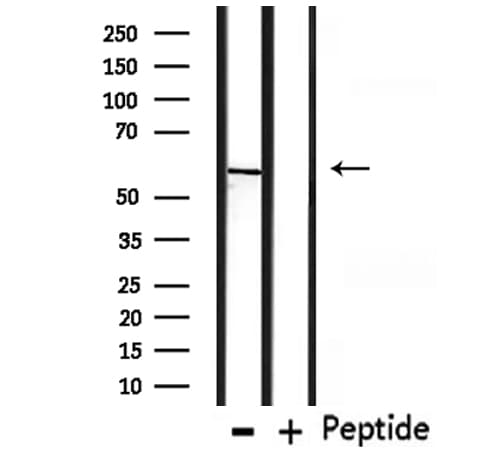 Polyclonal Rabbit anti-Human CHRNG Antibody (IHC, WB)
