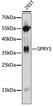 Polyclonal Rabbit anti-Human SPRY3 / Sprouty 3 Antibody (WB)