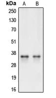 CASP3 / Caspase 3 Antibody (Internal)