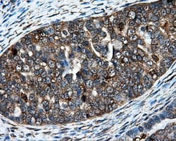IFT57 / HIPPI Antibody (clone OTI4F6)
